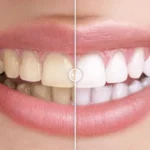 Before & After Images Comparison WordPress Plugin