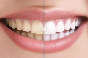 Mua Before & After Images Comparison WordPress Plugin giá rẻ